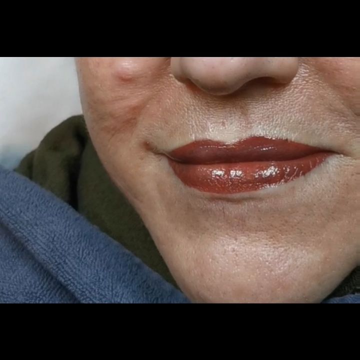 Eine Lippenpigmentierung direkt nach der Behandlung 💋
Dauer: 1,5-2 Stunden
Heilungsphase : 4 Tage
Ergebnis : 40-50% heller
Schmerzlevel : niedrig bis mittel
Nacharbeit : 1, optional noch eine Zweite, im Abstand von 6 Wochen
#permanentmakeup #Poppenbüttel #semipermanentmakeup #hamburg #lips #lippenstift #lipstick #lippenpigmentierung #biotek #Permablend #lippen #kissylips