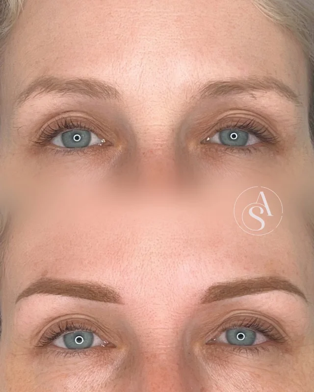 Beispiel für ein korrigiertes Permanent Make-Up an Lippen